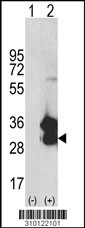 Western blot analysis of his-tag FGF14 (arrow) using his tag antibody. 293 cell lysates (2 ug/lane) either nontransfected (Lane 1) or transiently transfected with the FGF14 gene (Lane 2, Cat. #LY10122a).