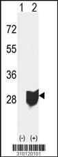 Western blot analysis of his-tag UCHL1 (arrow) using his tag antibody. 293 cell lysates (2 ug/lane) either nontransfected (Lane 1) or transiently transfected with the UCHL1 gene (Lane 2, Cat. #LY10120a).