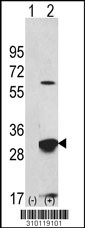 Western blot analysis of his-tag PSMB4 (arrow) using his tag antibody. 293 cell lysates (2 ug/lane) either nontransfected (Lane 1) or transiently transfected with the PSMB4 gene (Lane 2, Cat. #LY10119a).