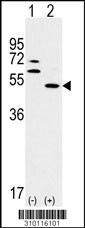 Western blot analysis of his-tag RELA (arrow) using his tag antibody. 293 cell lysates (2 ug/lane) either nontransfected (Lane 1) or transiently transfected with the RELA gene (Lane 2, Cat. #LY10116a).
