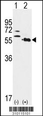 Western blot analysis of his-tag PRKAR1A (arrow) using his tag antibody. 293 cell lysates (2 ug/lane) either nontransfected (Lane 1) or transiently transfected with the PRKAR1A gene (Lane 2, Cat. #LY10115a).