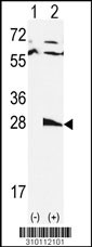 Western blot analysis of his-tag PSMA2 (arrow) using his tag antibody. 293 cell lysates (2 ug/lane) either nontransfected (Lane 1) or transiently transfected with the PSMA2 gene (Lane 2, Cat. #LY10112a).