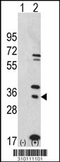 Western blot analysis of his-tag PSMB7 (arrow) using his tag antibody. 293 cell lysates (2 ug/lane) either nontransfected (Lane 1) or transiently transfected with the PSMB7 gene (Lane 2, Cat. #LY10111a).