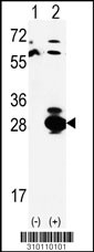 Western blot analysis of his-tag PSMB6 (arrow) using his tag antibody. 293 cell lysates (2 ug/lane) either nontransfected (Lane 1) or transiently transfected with the PSMB6 gene (Lane 2, Cat. #LY10110a).