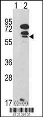 Western blot analysis of his-tag CDK8 (arrow) using his tag antibody. 293 cell lysates (2 ug/lane) either nontransfected (Lane 1) or transiently transfected with the CDK8 gene (Lane 2, Cat. #LY10109a).