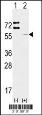 Western blot analysis of his-tag IKBKB (arrow) using his tag antibody. 293 cell lysates (2 ug/lane) either nontransfected (Lane 1) or transiently transfected with the IKBKB gene (Lane 2, Cat. #LY10108a).