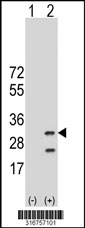 Western blot analysis of his-tag C19orf39 (arrow) using his tag antibody. 293T cell lysates (2 ug/lane) either nontransfected (Lane 1) or transiently transfected with the C19orf39 gene‘