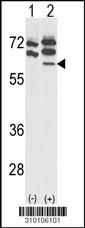 Western blot analysis of his-tag PTPN11 (arrow) using his tag antibody. 293 cell lysates (2 ug/lane) either nontransfected (Lane 1) or transiently transfected with the PTPN11 gene (Lane 2, Cat. #LY10106a).