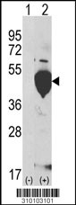 Western blot analysis of his-tag LDHB (arrow) using his tag antibody. 293 cell lysates (2 ug/lane) either nontransfected (Lane 1) or transiently transfected with the LDHB gene (Lane 2, Cat. #LY10103a).