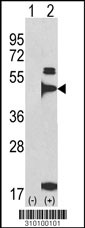 Western blot analysis of his-tag INHBA (arrow) using his tag antibody. 293 cell lysates (2 ug/lane) either nontransfected (Lane 1) or transiently transfected with the INHBA gene (Lane 2, Cat. #LY10100a).