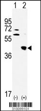 Western blot analysis of his-tag OGN (arrow) using his tag antibody. 293 cell lysates (2 ug/lane) either nontransfected (Lane 1) or transiently transfected with the OGN gene (Lane 2, Cat. #LY10099a).