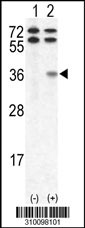 Western blot analysis of his-tag CCND1 (arrow) using his tag antibody. 293 cell lysates (2 ug/lane) either nontransfected (Lane 1) or transiently transfected with the CCND1 gene (Lane 2, Cat. #LY10098a).