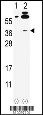 Western blot analysis of his-tag PAK2? (arrow) using his tag antibody. 293 cell lysates (2 ug/lane) either nontransfected (Lane 1) or transiently transfected with the PAK2? gene (Lane 2, Cat. #LY10097a).