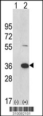 Western blot analysis of his-tag SPRED2 (arrow) using his tag antibody. 293 cell lysates (2 ug/lane) either nontransfected (Lane 1) or transiently transfected with the SPRED2 gene (Lane 2, Cat. #LY10096a).