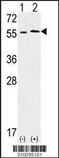 Western blot analysis of his-tag UGP2 (arrow) using his tag antibody. 293 cell lysates (2 ug/lane) either nontransfected (Lane 1) or transiently transfected with the UGP2 gene (Lane 2, Cat. #LY10095a).