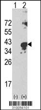 Western blot analysis of his-tag PRKRA (arrow) using his tag antibody. 293 cell lysates (2 ug/lane) either nontransfected (Lane 1) or transiently transfected with the PRKRA gene (Lane 2, Cat. #LY10094a).