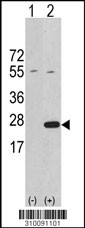 Western blot analysis of his-tag CSH1 (arrow) using his tag antibody. 293 cell lysates (2 ug/lane) either nontransfected (Lane 1) or transiently transfected with the CSH1 gene (Lane 2, Cat. #LY10091a).