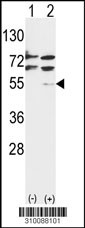Western blot analysis of his-tag AURKA (arrow) using his tag antibody. 293 cell lysates (2 ug/lane) either nontransfected (Lane 1) or transiently transfected with the AURKA gene (Lane 2, Cat. #LY10088a).