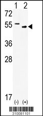 Western blot analysis of his-tag PPM1A (arrow) using his tag antibody. 293 cell lysates (2 ug/lane) either nontransfected (Lane 1) or transiently transfected with the PPM1A gene (Lane 2, Cat. #LY10081a).