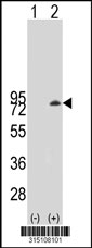 Western blot analysis of his-tag CEP76 (arrow) using his tag antibody. 293T cell lysates (2 ug/lane) either nontransfected (Lane 1) or transiently transfected with the CEP76 gene‘