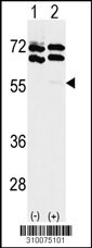 Western blot analysis of his-tag PIK3R5 (arrow) using his tag antibody. 293 cell lysates (2 ug/lane) either nontransfected (Lane 1) or transiently transfected with the PIK3R5 gene (Lane 2, Cat. #LY10075a).