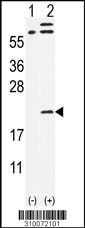 Western blot analysis of his-tag MDK (arrow) using his tag antibody. 293 cell lysates (2 ug/lane) either nontransfected (Lane 1) or transiently transfected with the MDK gene (Lane 2, Cat. #LY10072a).