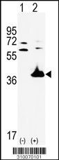Western blot analysis of his-tag IL1A (arrow) using his tag antibody. 293 cell lysates (2 ug/lane) either nontransfected (Lane 1) or transiently transfected with the IL1A gene (Lane 2, Cat. #LY10070a).