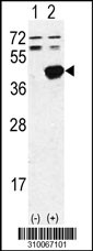 Western blot analysis of his-tag SEPHS1 (arrow) using his tag antibody. 293 cell lysates (2 ug/lane) either nontransfected (Lane 1) or transiently transfected with the SEPHS1 gene (Lane 2, Cat. #LY10067a).