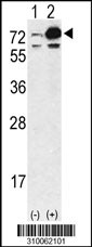 Western blot analysis of his-tag CSF1 (arrow) using his tag antibody. 293 cell lysates (2 ug/lane) either nontransfected (Lane 1) or transiently transfected with the CSF1 gene (Lane 2, Cat. #LY10062a).