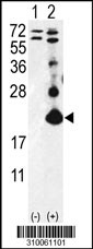 Western blot analysis of his-tag PTN (arrow) using his tag antibody. 293 cell lysates (2 ug/lane) either nontransfected (Lane 1) or transiently transfected with the PTN gene (Lane 2, Cat. #LY10061a).