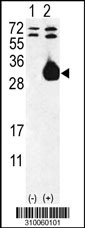 Western blot analysis of his-tag VEGFB (arrow) using his tag antibody. 293 cell lysates (2 ug/lane) either nontransfected (Lane 1) or transiently transfected with the VEGFB gene (Lane 2, Cat. #LY10060a).