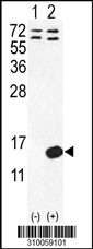 Western blot analysis of his-tag CXCL12 (arrow) using his tag antibody. 293 cell lysates (2 ug/lane) either nontransfected (Lane 1) or transiently transfected with the CXCL12 gene (Lane 2, Cat. #LY10059a).