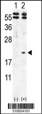 Western blot analysis of his-tag PNCK (arrow) using his tag antibody. 293 cell lysates (2 ug/lane) either nontransfected (Lane 1) or transiently transfected with the PNCK gene (Lane 2, Cat. #LY10054a).