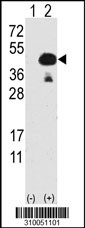 Western blot analysis of his-tag SCYE1 (arrow) using his tag antibody. 293 cell lysates (2 ug/lane) either nontransfected (Lane 1) or transiently transfected with the SCYE1 gene (Lane 2, Cat. #LY10051a).