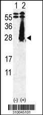Western blot analysis of his-tag FGF18 (arrow) using his tag antibody. 293 cell lysates (2 ug/lane) either nontransfected (Lane 1) or transiently transfected with the FGF18 gene (Lane 2, Cat. #LY10045a).