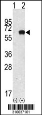 Western blot analysis of his-tag PTPN6 (arrow) using his tag antibody. 293 cell lysates (2 ug/lane) either nontransfected (Lane 1) or transiently transfected with the PTPN6 gene (Lane 2, Cat. #LY10037a).