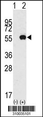 Western blot analysis of his-tag TGFB3 (arrow) using his tag antibody. 293 cell lysates (2 ug/lane) either nontransfected (Lane 1) or transiently transfected with the TGFB3 gene (Lane 2, Cat. #LY10035a).