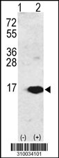 Western blot analysis of his-tag S100A6 (arrow) using his tag antibody. 293 cell lysates (2 ug/lane) either nontransfected (Lane 1) or transiently transfected with the S100A6 gene (Lane 2, Cat. #LY10034a).