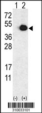 Western blot analysis of his-tag P11 (arrow) using his tag antibody. 293 cell lysates (2 ug/lane) either nontransfected (Lane 1) or transiently transfected with the P11 gene (Lane 2, Cat. #LY10033a).