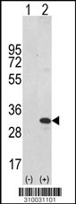 Western blot analysis of his-tag NTF4 (arrow) using his tag antibody. 293 cell lysates (2 ug/lane) either nontransfected (Lane 1) or transiently transfected with the NTF4 gene (Lane 2, Cat. #LY10031a).
