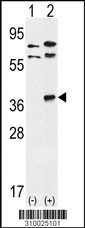 Western blot analysis of his-tag PIM1 (arrow) using his tag antibody. 293 cell lysates (2 ug/lane) either nontransfected (Lane 1) or transiently transfected with the PIM1 gene (Lane 2, Cat. #LY10025a).