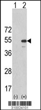 Western blot analysis of his-tag CHEK2 (arrow) using his tag antibody. 293 cell lysates (2 ug/lane) either nontransfected (Lane 1) or transiently transfected with the CHEK2 gene (Lane 2, Cat. #LY10024a).