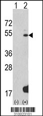 Western blot analysis of his-tag HNF4G (arrow) using his tag antibody. 293 cell lysates (2 ug/lane) either nontransfected (Lane 1) or transiently transfected with the HNF4G gene (Lane 2, Cat. #LY10023a).