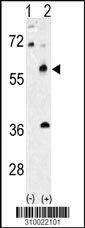 Western blot analysis of his-tag ESRRG (arrow) using his tag antibody. 293 cell lysates (2 ug/lane) either nontransfected (Lane 1) or transiently transfected with the ESRRG gene (Lane 2, Cat. #LY10022a).
