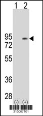 Western blot analysis of his-tag UTP6 (arrow) using his tag antibody. 293T cell lysates (2 ug/lane) either nontransfected (Lane 1) or transiently transfected with the UTP6 gene‘