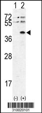 Western blot analysis of his-tag MAPKAPK3 (arrow) using his tag antibody. 293 cell lysates (2 ug/lane) either nontransfected (Lane 1) or transiently transfected with the MAPKAPK3 gene (Lane 2, Cat. #LY10020a).