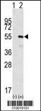 Western blot analysis of his-tag CAMK2D (arrow) using his tag antibody. 293 cell lysates (2 ug/lane) either nontransfected (Lane 1) or transiently transfected with the CAMK2D gene (Lane 2, Cat. #LY10019a).