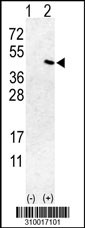 Western blot analysis of his-tag NPM1 (arrow) using his tag antibody. 293 cell lysates (2 ug/lane) either nontransfected (Lane 1) or transiently transfected with the NPM1 gene (Lane 2, Cat. #LY10017a).