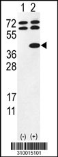 Western blot analysis of his-tag CDK6 (arrow) using his tag antibody. 293 cell lysates (2 ug/lane) either nontransfected (Lane 1) or transiently transfected with the CDK6 gene (Lane 2, Cat. #LY10015a).