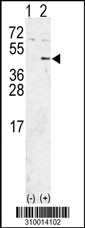 Western blot analysis of his-tag PRKCDBP (arrow) using his tag antibody. 293 cell lysates (2 ug/lane) either nontransfected (Lane 1) or transiently transfected with the PRKCDBP gene (Lane 2, Cat. #LY10014a).